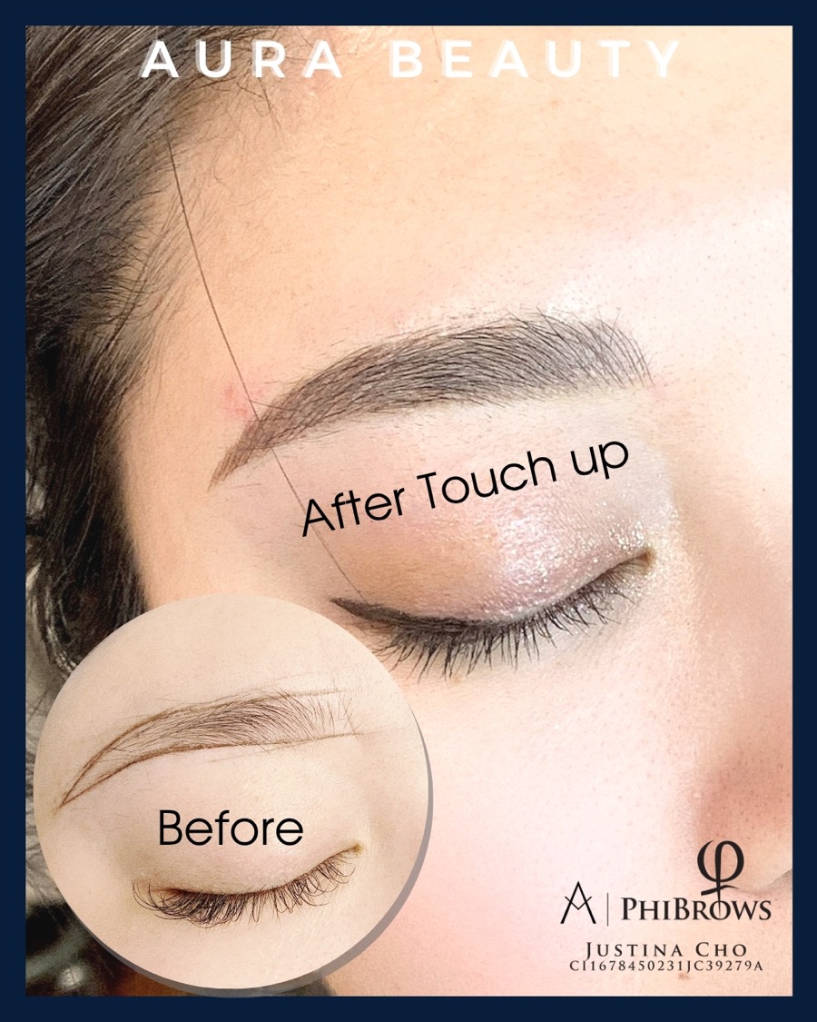 Brow touch-up close-up: healed result alongside the before reference.